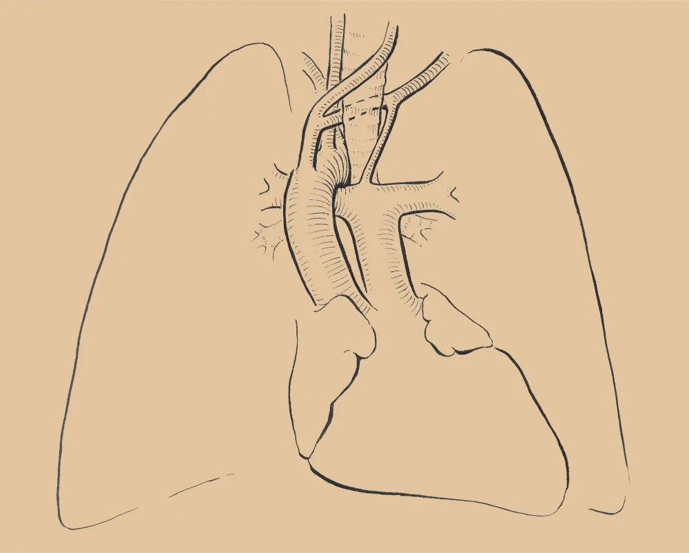 Skitse af lunger og muskulatur, der illustrerer vejrtrækning og støtte for sangere
